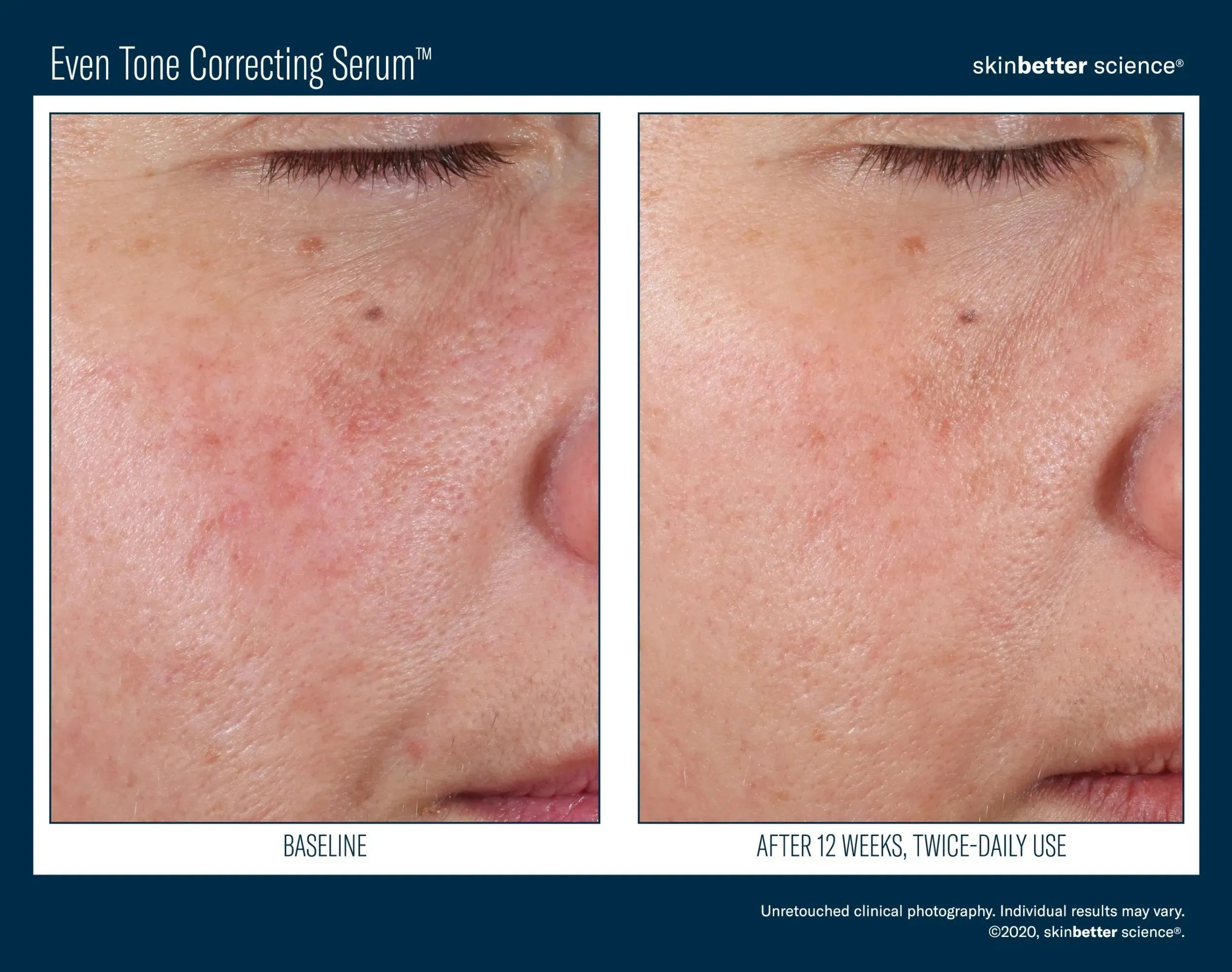 Even Tone Correcting Serum