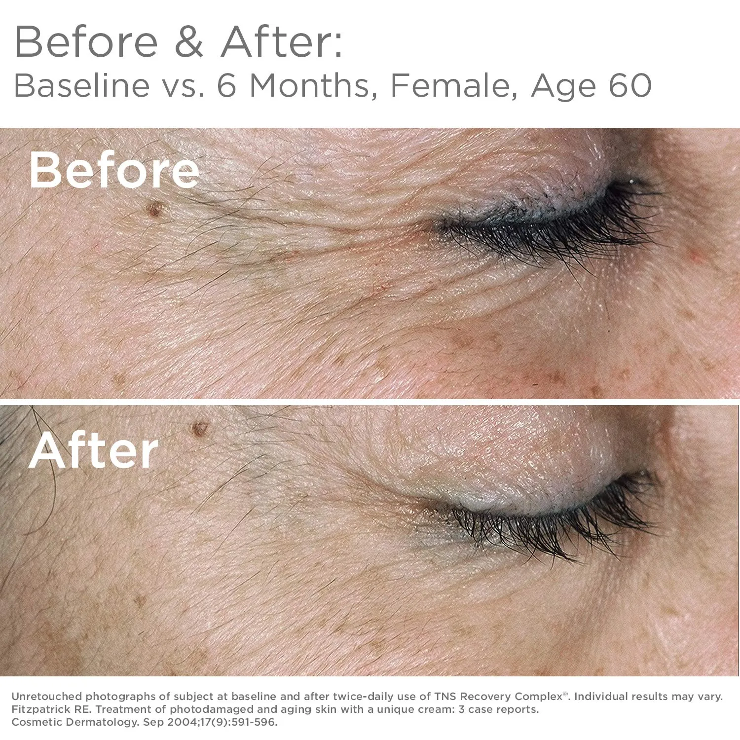 SkinMedica TNS Recovery Complex®